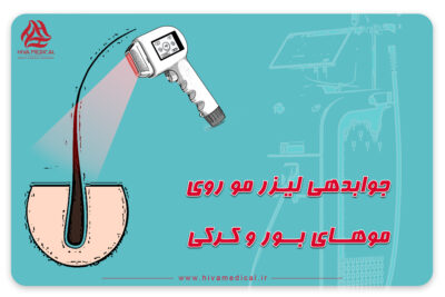 لیزر موی کرکی